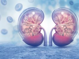 Obesity linked to kidney disease