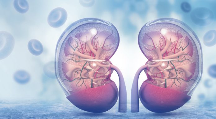 Obesity Linked To Development and Progression Of Kindney Diseases Amongst Indians Obesity linked to kidney disease