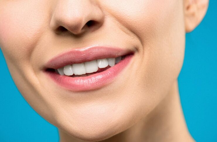 getting braces